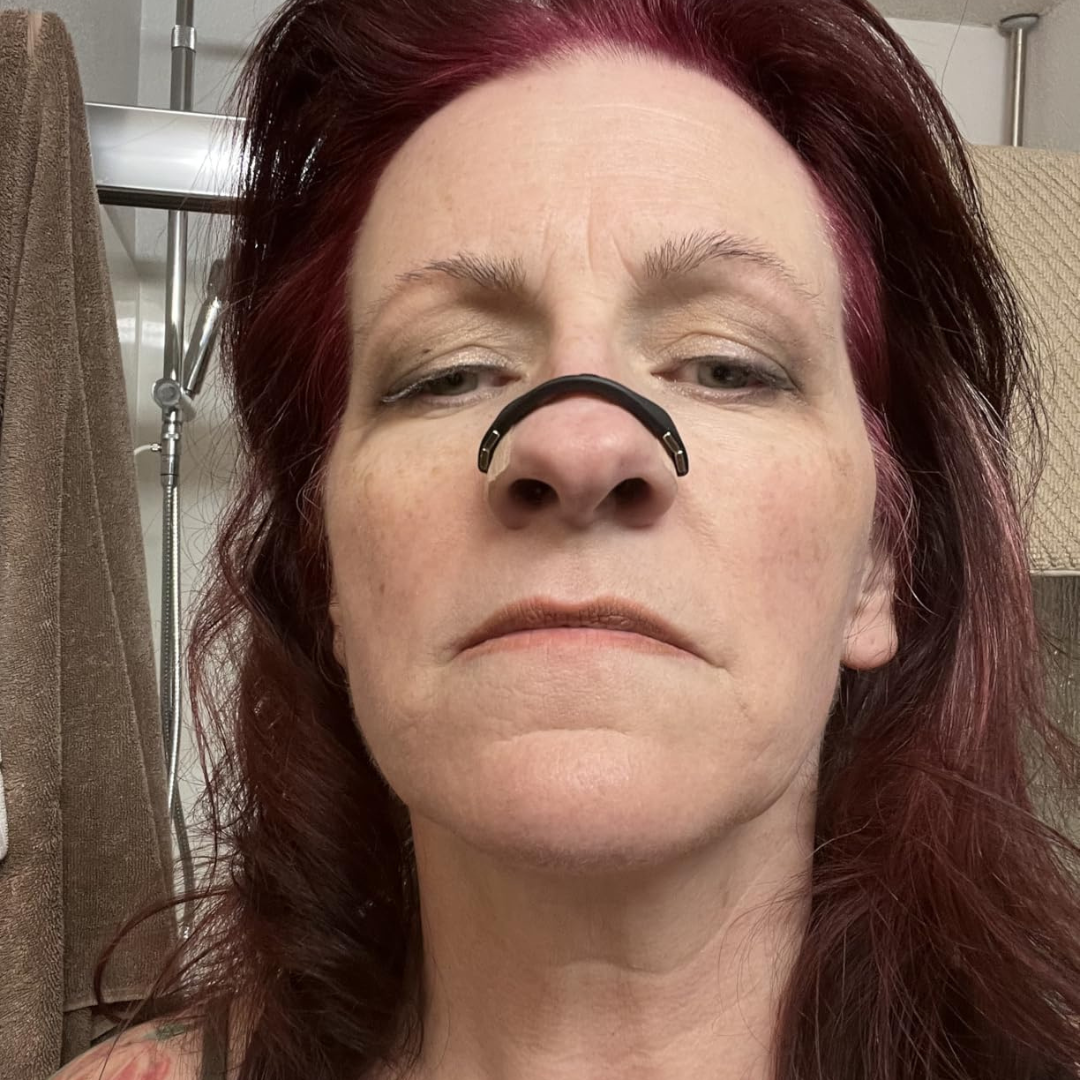 HelioMD BreathBetter Magnetic Nose Strips