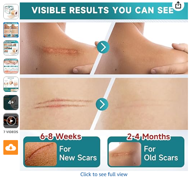 Advanced Silicone Scar Sheets