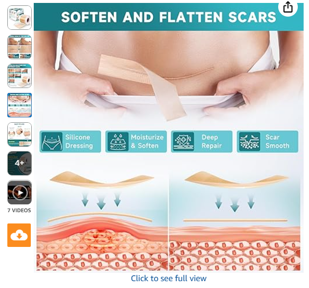 Advanced Silicone Scar Sheets