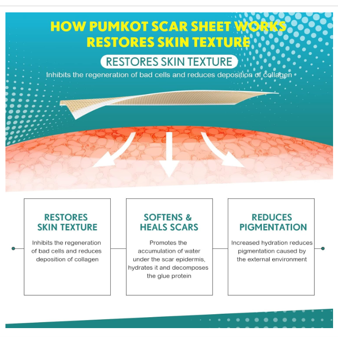 Advanced Silicone Scar Sheets