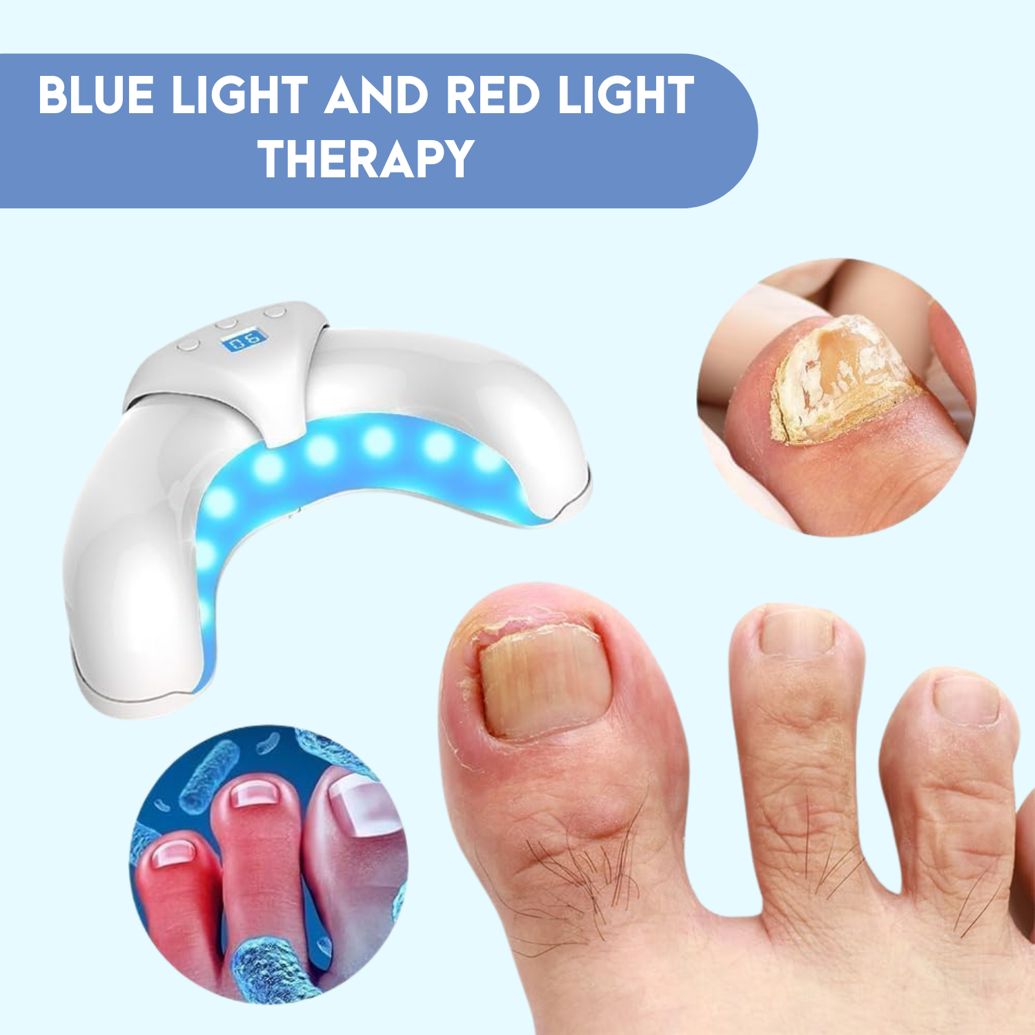 HelioCare AntiFungal Treatment