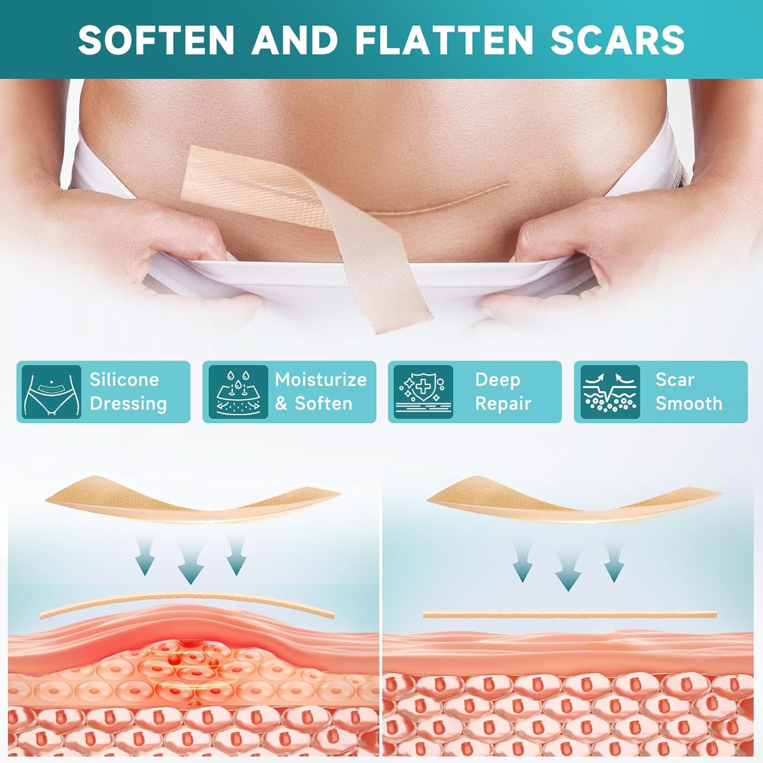 HelioMD Scar Silicone Tape