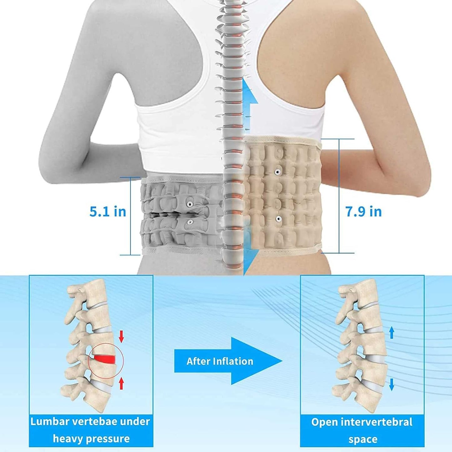 HelioMD - Lumbar RX